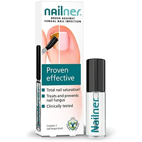 Nailner feature image